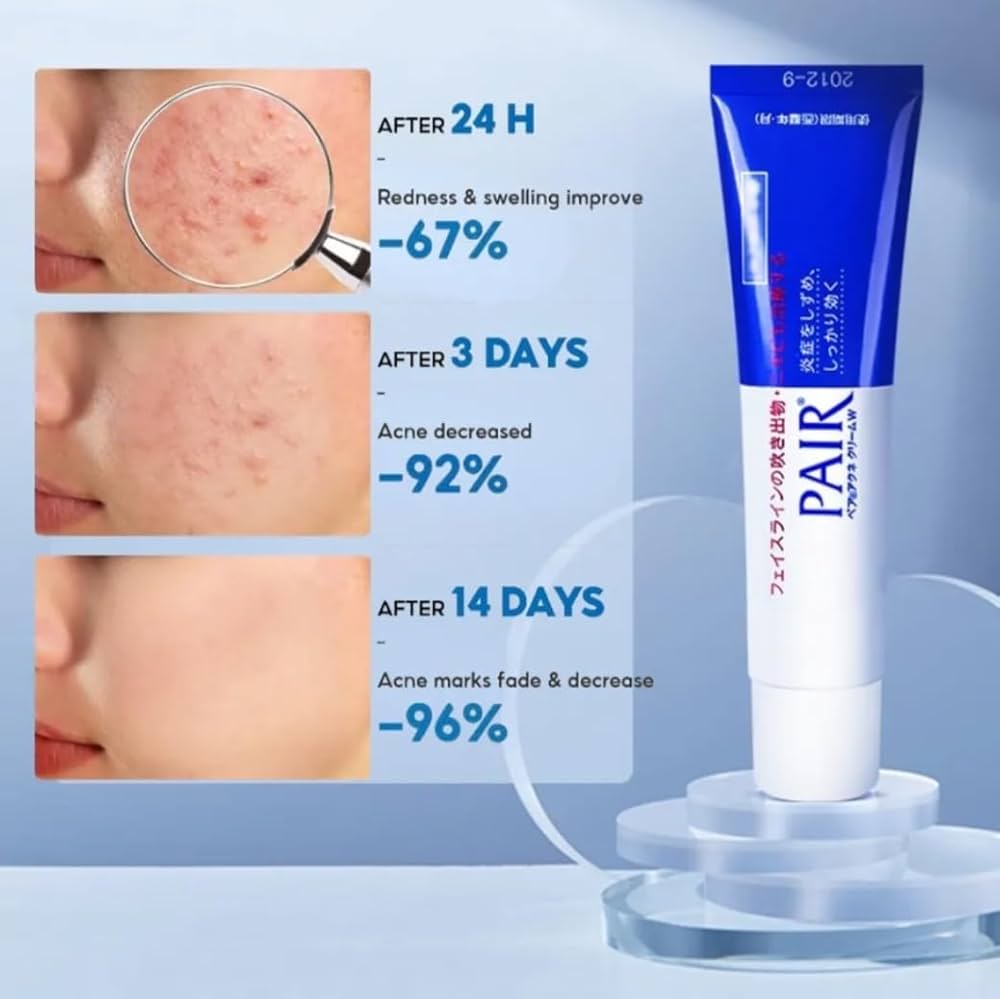 LION PAIR ACNE CREAM W 24G