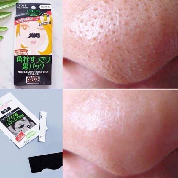 Kose Softymo Keratin Plug Cleaning Super Black Pack 10 pieces - Image 4