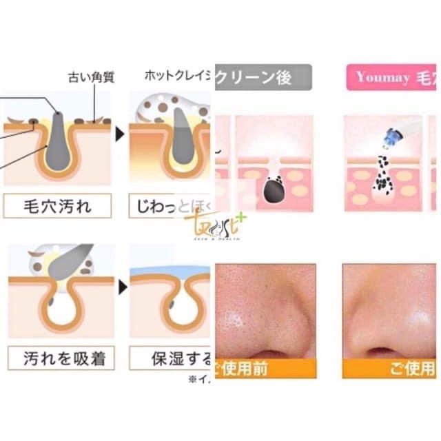 Kose Softymo Keratin Plug Cleaning Super Black Pack 10 pieces - Image 5